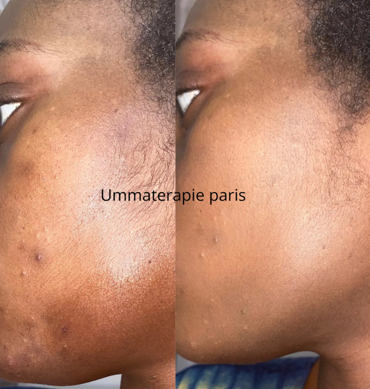 Pack Nila