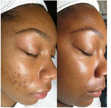 Masque Visage Curcuma
